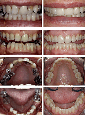 Restorative Dental Treatments